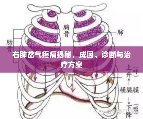 右肺岔气疼痛揭秘，成因、诊断与治疗方案